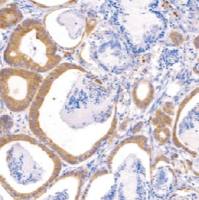 兔抗人COX-2单克隆抗体  TDCCR-1151