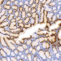 鼠抗人细胞角蛋白20单克隆抗体 TDCCM-1110