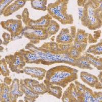 兔抗人c-Met 单克隆抗体  TDCCR-0250