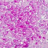 中杉金桥  BSBA-4080A  糖原染色液（PAS）3×20ml