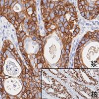 中杉金桥  PV-9004  大鼠二步法试剂盒（大鼠增强聚合物法检测系统）6ml