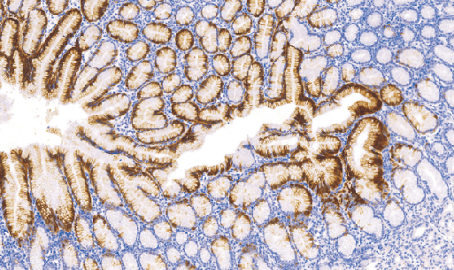 鼠抗人细胞角蛋白20单克隆抗体 TDCCM-1110