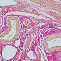 中杉金桥  BSBA-4084A  Van Gieson染色液 3×20ml