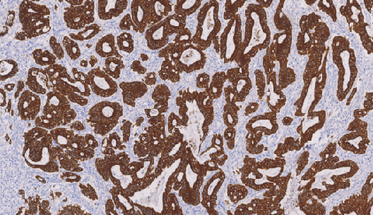 鼠抗人细胞角蛋白18单克隆抗体 TDCCM-1090