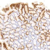 鼠抗人细胞角蛋白20单克隆抗体  TDCCM-1113