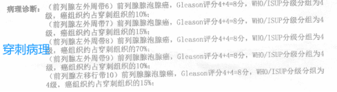 佲医荟案例：打破晚期癌症预估生存期，不放弃就有希望！