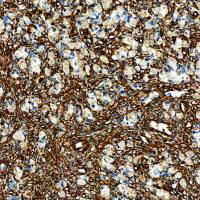 中杉金桥  ZA-0511  Vimentin抗体试剂（免疫组织化学）0.2ml