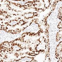 中杉金桥 ZA-0129 HNF1-Beta抗体试剂(免疫组织化学)