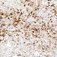 中杉金桥  ZA-0344  促黄体生成素Luteinizing Hormone 抗体试剂（免疫组织化学）