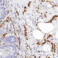 中杉金桥  ZA-0225  S100抗体试剂（免疫组织化学）