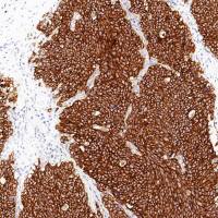 中杉金桥  ZA-0506  Synaptophysin抗体试剂（免疫组织化学）