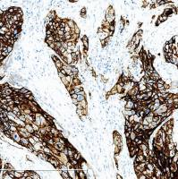 中杉金桥  ZA-0505  EGFR（表皮生长因子受体）抗体试剂 （免疫组织化学）