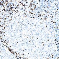 中杉金桥  ZA-0508  CD8抗体试剂（免疫组织化学）