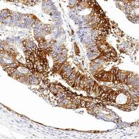 中杉金桥  ZA-0471  Glut-1蛋白GLUT-1 抗体试剂（免疫组织化学）