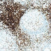 中杉金桥  ZA-0503  CD3抗体试剂（免疫组织化学）