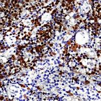 中杉金桥  ZA-0101  细胞周期蛋白D1抗体试剂 （免疫组织化学）