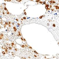 中杉金桥  ZA-0197  Myeloperoxidase 抗体试剂 （免疫组织化学）