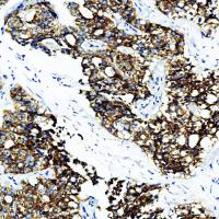 中杉金桥  ZA-0227  AMACR/p504s抗体试剂（免疫组织化学）