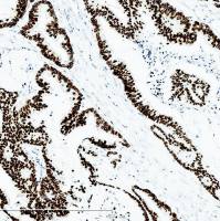 中杉金桥  ZA-0520  CDX-2抗体试剂（免疫组织化学）