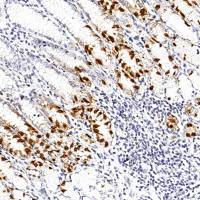 中杉金桥  ZA-0115  Gastrin抗体试剂（免疫组织化学）