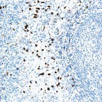 中杉金桥  ZA-0446  IgA抗体试剂（免疫组织化学）