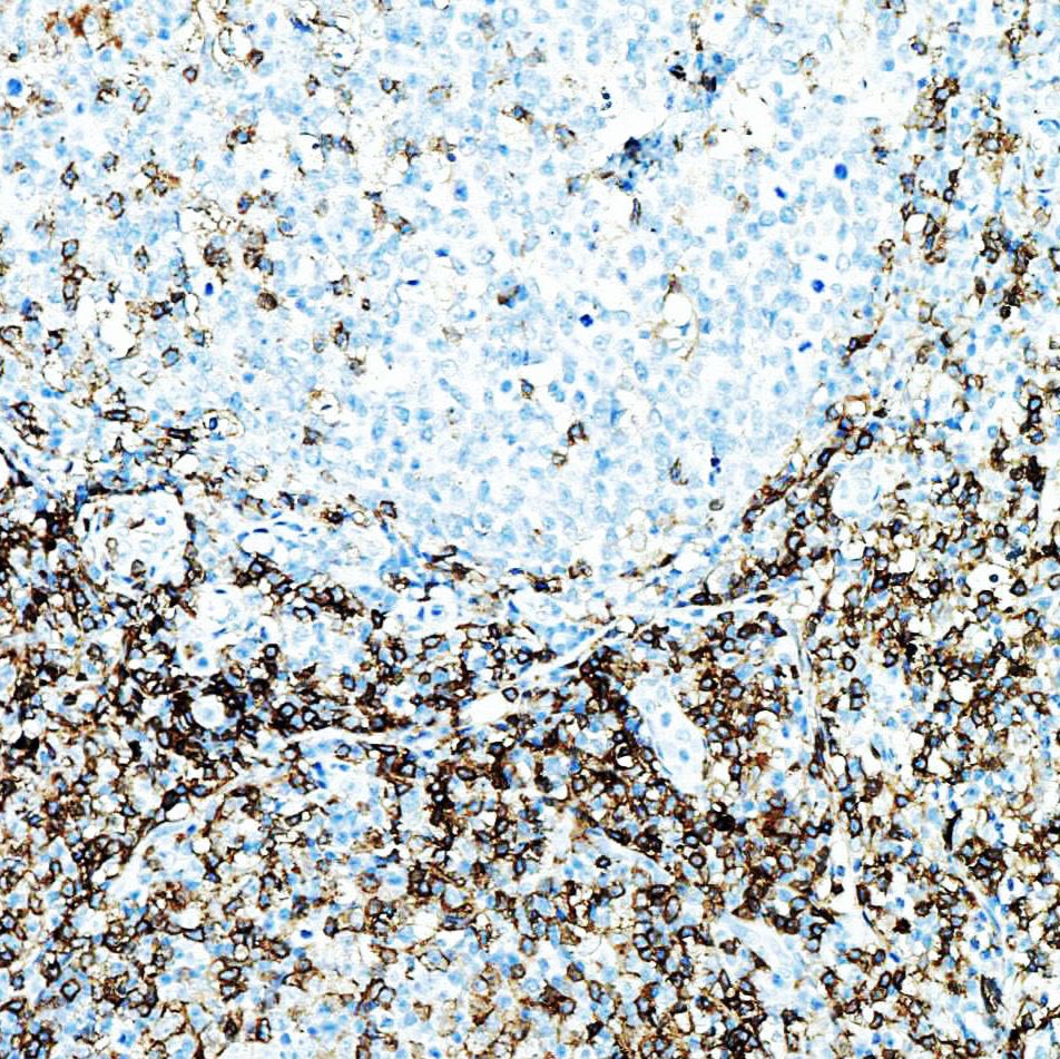 中杉金桥  ZA-0519  CD4辅助/诱导T细胞 CD4抗体试剂（免疫组织化学）