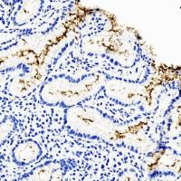 中杉金桥  ZA-0127  Helicobacter phlori抗体试剂（免疫组织化学）