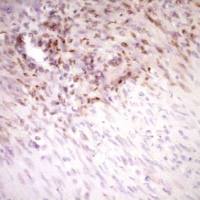 中杉金桥  TA806750  试剂Stabilin2