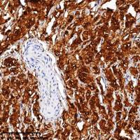 中杉金桥  ZA-0026  Calretinin 抗体试剂（免疫组织化学）