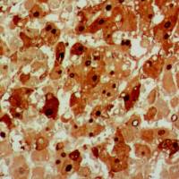 中杉金桥  ZA-0121  HBcAg抗体试剂