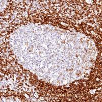 中杉金桥 ZA-0443 IgD 抗体试剂(免疫组织化学)