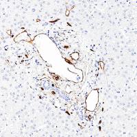 中杉金桥 ZA-0550 CD34抗体试剂(免疫组织化学)
