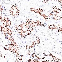 中杉金桥  ZA-0554  AR(AndrogenReceptor)雄激素受体