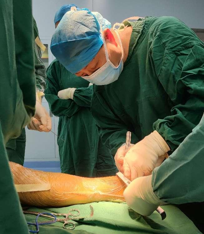 自治区南溪山医院完成定制化人工踝关节置换