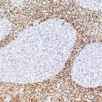 中杉金桥  ZA-0536  bcl-2抗体试剂（免疫组织化学）