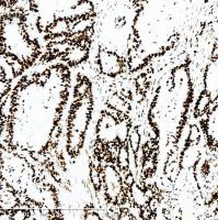 中杉金桥  ZA-0541  MSH6抗体试剂（免疫组织化学）1.5ml