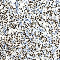 中杉金桥 ZA-0555 c-MYC抗体试剂(免疫组织化学)