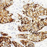 中杉金桥  ZA-0565  E-Cadherin抗体试剂（免疫组织化学）