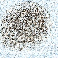 中杉金桥 ZA-0525 CD21抗体试剂(免疫组织化学)