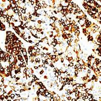 中杉金桥 ZA-0540 细胞角蛋白14抗体试剂(免疫组织化学)