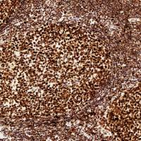 中杉金桥  ZA-0542  PMS2抗体试剂（免疫组织化学）6ml