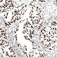 中杉金桥  ZA-0559  WT1抗体试剂（免疫组织化学）