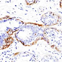 中杉金桥 ZA-0524 Calponin抗体试剂(免疫组织化学)