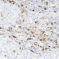 中杉金桥  ZA-0562  基质金属蛋白酶-9MMP-9 抗体试剂（免疫组织化学）