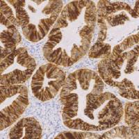 兔抗人E-钙粘附蛋白单克隆抗体  TDCER-0022