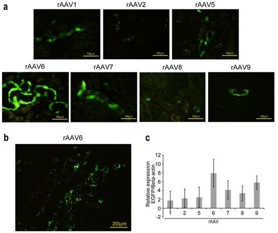 AAV 在肾脏疾病研究中的应用