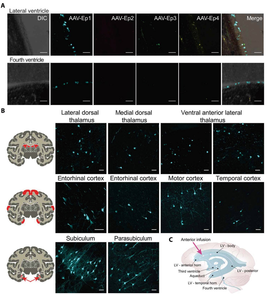 AAV 在神经科学研究中的应用策略
