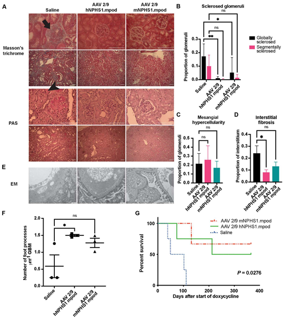 AAV 在肾脏疾病研究中的应用