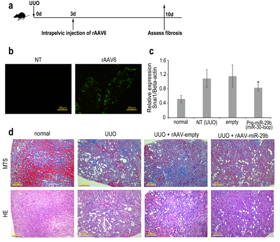 AAV 在肾脏疾病研究中的应用