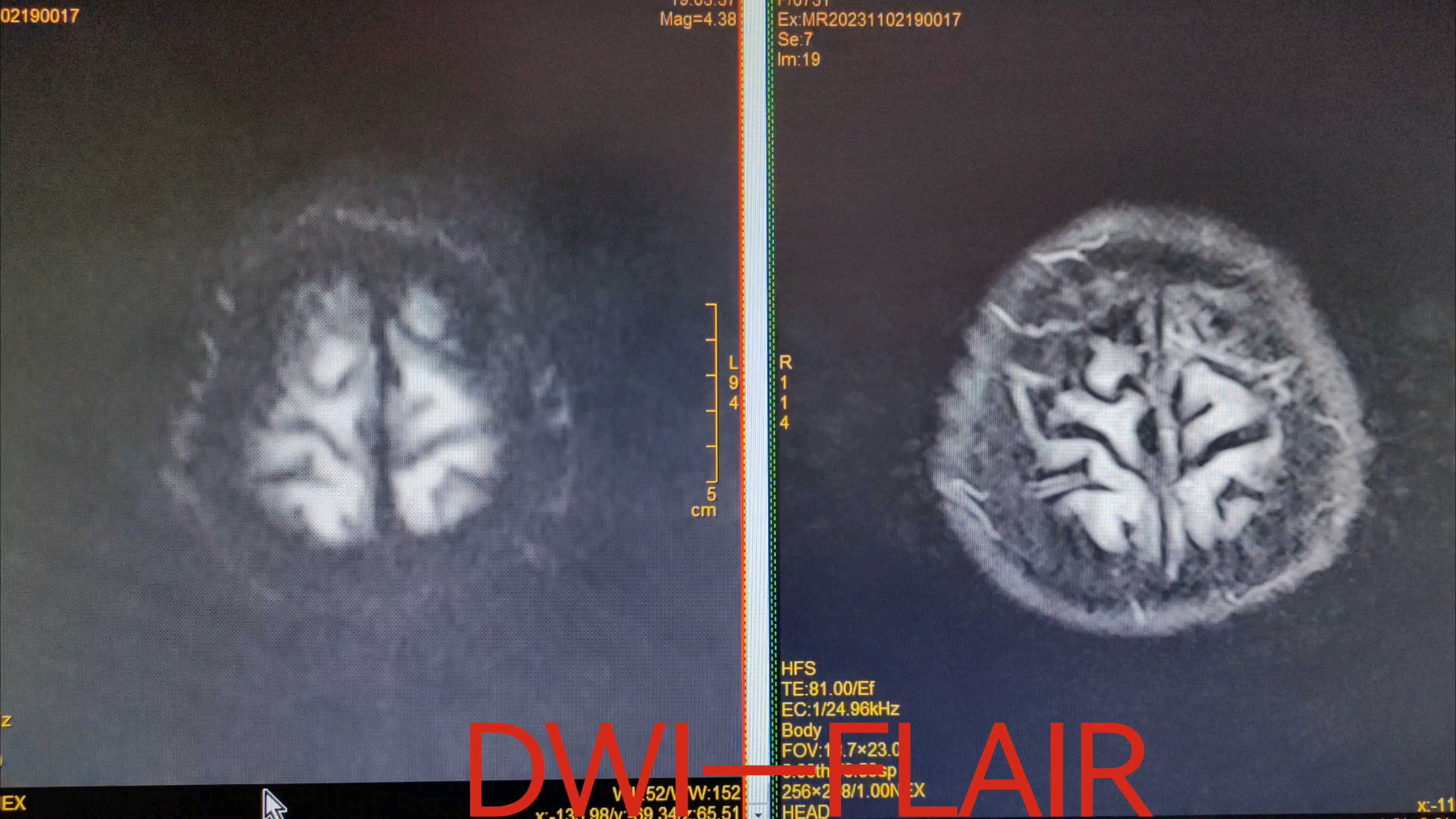 甲辰龙年首篇拂尘见金解头晕